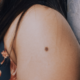 mole