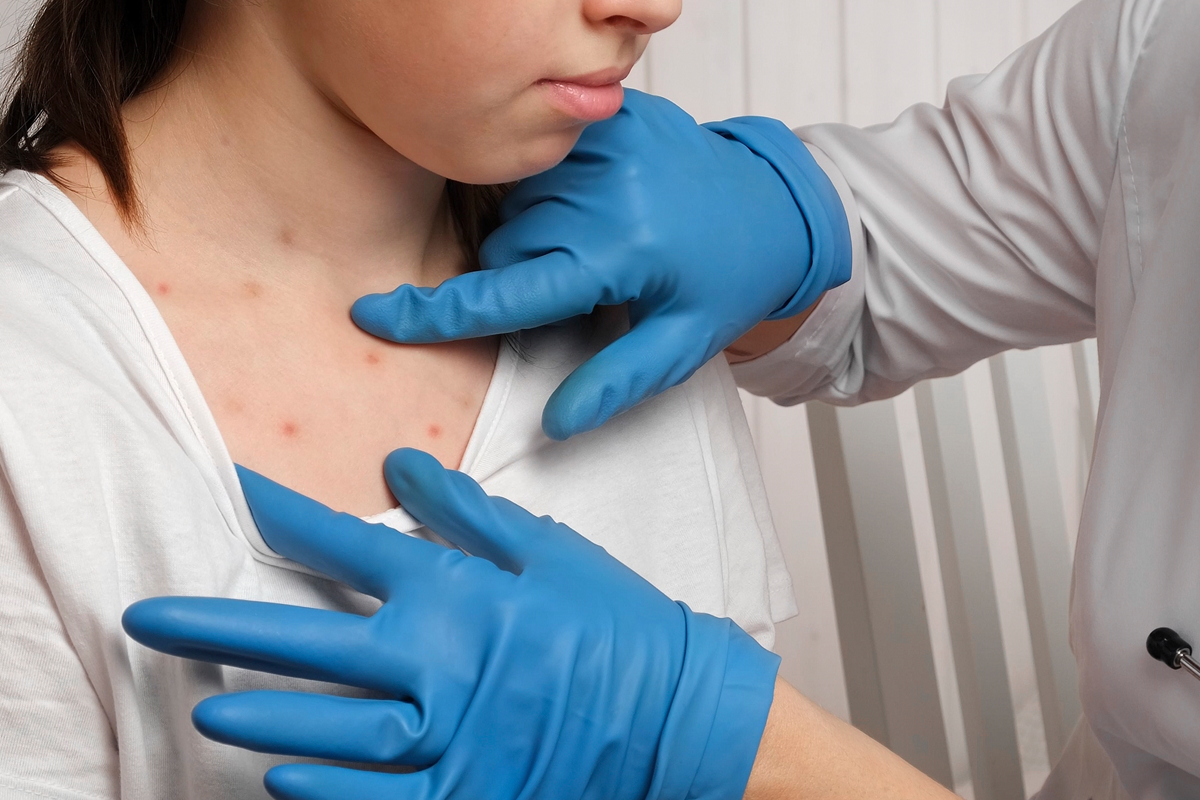 Family Dermatology