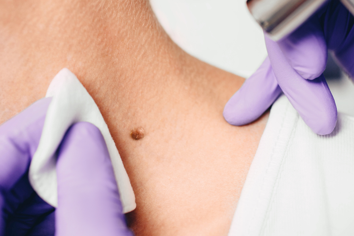 Surgical Dermatology